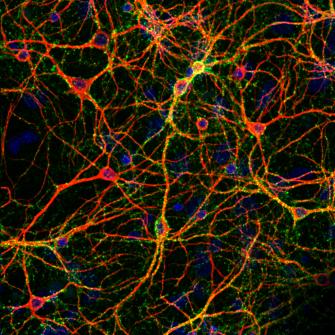 hiPSC-derived neurons - Mall lab